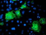 KATNB1 Antibody in Immunocytochemistry (ICC/IF)