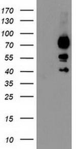 KATNB1 Antibody in Western Blot (WB)