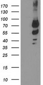 KATNB1 Antibody in Western Blot (WB)