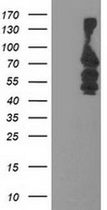 KATNB1 Antibody in Western Blot (WB)