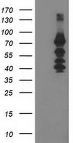 KATNB1 Antibody in Western Blot (WB)