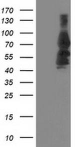 KATNB1 Antibody in Western Blot (WB)