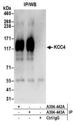 KCC4 Antibody in Western Blot (WB)