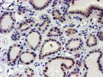 KCNAB1 Antibody in Immunohistochemistry (Paraffin) (IHC (P))