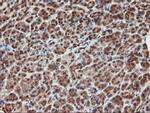 KCNAB1 Antibody in Immunohistochemistry (Paraffin) (IHC (P))