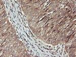 KCNAB1 Antibody in Immunohistochemistry (Paraffin) (IHC (P))