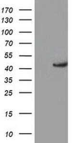 KCNAB1 Antibody in Western Blot (WB)