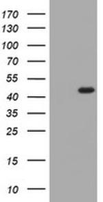 KCNAB1 Antibody in Western Blot (WB)