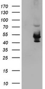 KCNAB1 Antibody in Western Blot (WB)