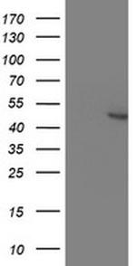 KCNAB1 Antibody in Western Blot (WB)