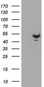 KCNAB1 Antibody in Western Blot (WB)