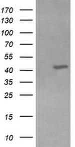 KCNAB1 Antibody in Western Blot (WB)