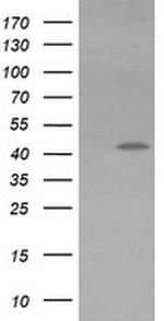 KCNAB1 Antibody in Western Blot (WB)