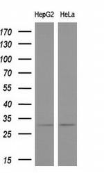 KCNIP2 Antibody in Western Blot (WB)