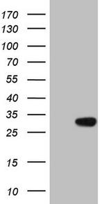 KCNIP2 Antibody in Western Blot (WB)