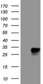 KCNIP2 Antibody in Western Blot (WB)