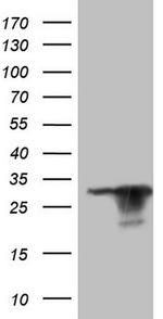 KCNIP2 Antibody in Western Blot (WB)