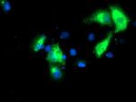 KCNJ3 Antibody in Immunocytochemistry (ICC/IF)