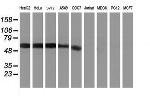 KCNJ3 Antibody in Western Blot (WB)