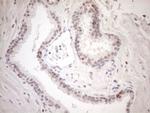 KCTD13 Antibody in Immunohistochemistry (Paraffin) (IHC (P))