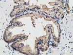 KCTD14 Antibody in Immunohistochemistry (Paraffin) (IHC (P))