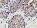 KCTD14 Antibody in Immunohistochemistry (Paraffin) (IHC (P))