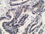 KCTD14 Antibody in Immunohistochemistry (Paraffin) (IHC (P))