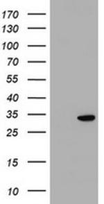 KCTD14 Antibody in Western Blot (WB)