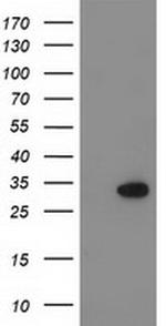 KCTD14 Antibody in Western Blot (WB)