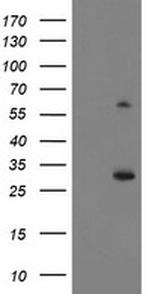 KCTD14 Antibody in Western Blot (WB)