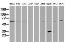 KCTD14 Antibody in Western Blot (WB)