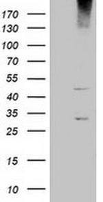 KCTD14 Antibody in Western Blot (WB)