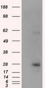 KCTD5 Antibody in Western Blot (WB)