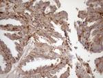 KCTD9 Antibody in Immunohistochemistry (Paraffin) (IHC (P))