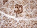 KCTD9 Antibody in Immunohistochemistry (Paraffin) (IHC (P))