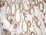 KCTD9 Antibody in Immunohistochemistry (Paraffin) (IHC (P))