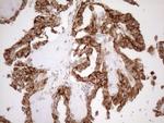 KCTD9 Antibody in Immunohistochemistry (Paraffin) (IHC (P))