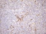 KCTD9 Antibody in Immunohistochemistry (Paraffin) (IHC (P))