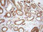 KCTD9 Antibody in Immunohistochemistry (Paraffin) (IHC (P))