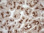 KCTD9 Antibody in Immunohistochemistry (Paraffin) (IHC (P))