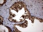 KCTD9 Antibody in Immunohistochemistry (Paraffin) (IHC (P))