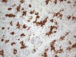 KCTD9 Antibody in Immunohistochemistry (Paraffin) (IHC (P))