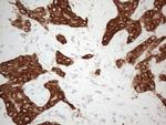 KCTD9 Antibody in Immunohistochemistry (Paraffin) (IHC (P))