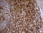 KDELC2 Antibody in Immunohistochemistry (Paraffin) (IHC (P))