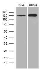 KDM3A Antibody in Western Blot (WB)