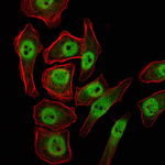 JMJD2A Antibody in Immunocytochemistry (ICC/IF)