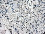 KDM4C Antibody in Immunohistochemistry (Paraffin) (IHC (P))