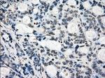 KDM4C Antibody in Immunohistochemistry (Paraffin) (IHC (P))