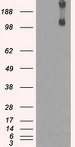 KDM4C Antibody in Western Blot (WB)