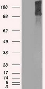 KDM4C Antibody in Western Blot (WB)